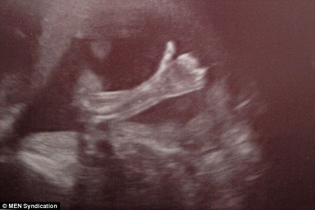 ��Ey!, mam� y pap�, por ac� todo bien�: una ecograf�a de 20 semanas